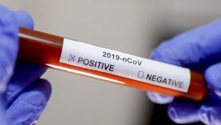Yeni növ koronavirusa daha 2261 nəfər yoluxub