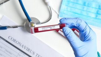 Azərbaycanda daha 1 151 nəfər koronavirusa yoluxub, 9 nəfər ölüb