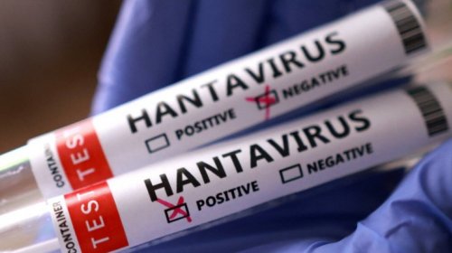 ÜST hantavirusa yoluxma sayının artdığını açıqladı