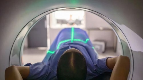 2050-ci ildə qorxulu mənzərə: Yoluxma sayı 35 milyona yaxınlaşacaq